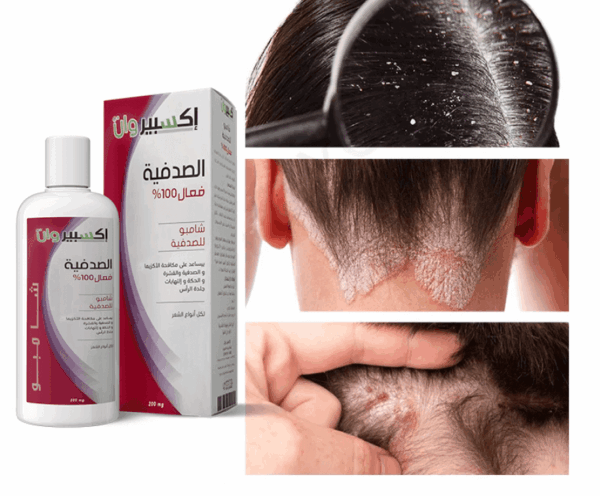 Shampoing Psoriasis d'ExpertOne – Image 2